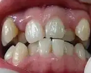 ݽı仯