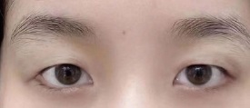 С۾ⳡӵлЦ˫Ƥ