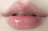微整形攻略玻尿酸丰唇多久补打一次