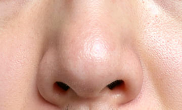 告别“塌鼻梁”焦虑！隆鼻技术重塑立体美颜新焦点