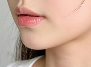 方脸女孩的“柔美”蜕变：下颌角的神奇转变