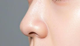 从“塌鼻妹”到侧颜女神的蜕变