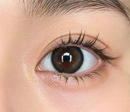 从单眼皮到灵动双眼皮：我的双眼皮手术蜕变记