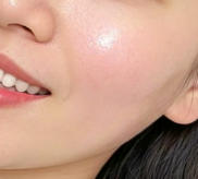 35岁职场妈妈热玛吉除皱：从焦虑到自信