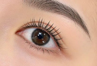 从单眼皮到明眸大眼：我的双眼皮手术真实体验