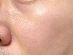 告别凹陷，拥抱饱满