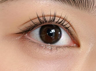 双眸焕彩，开启自信新篇章