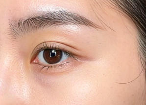 告别岁月刻痕，重焕青春光彩