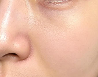 告别容貌焦虑，我找到了自信的“开关”