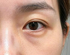 除皱焕颜：我与岁月痕迹的勇敢抗争