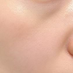 微整焕新：开启我的精致蜕变之旅