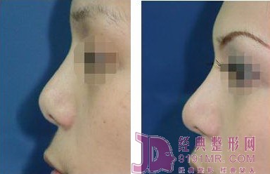 �Ǽ�����g(sh��)