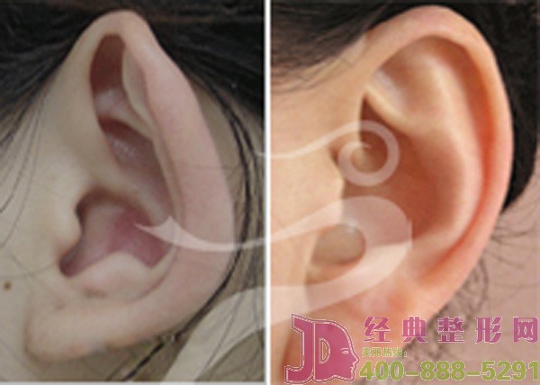 ������첻�����y�}