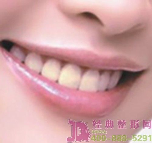 ��ν�Q�������X�C���ĳ�Ҋ���}