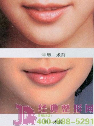 ע���S���и�����ô��