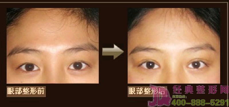 �۲��������ݰ���Ч��[�M�D]