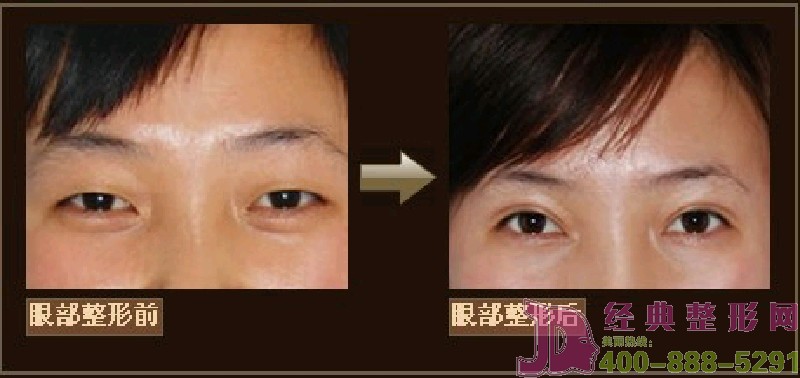 �۲��������ݰ���Ч��[�M�D]