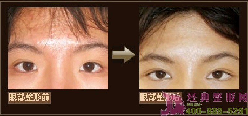 �۲��������ݰ���Ч��[�M�D]