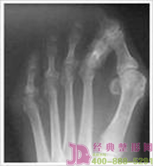 ���_�ǵİY���B