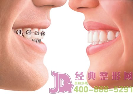 ���X�C����Ҫ���L�r�g