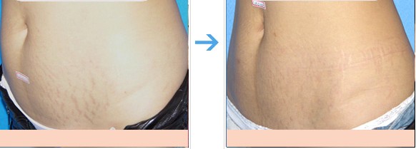 ����y���γ�ԭ��D