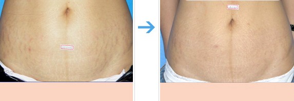 ����y���γ�ԭ��D