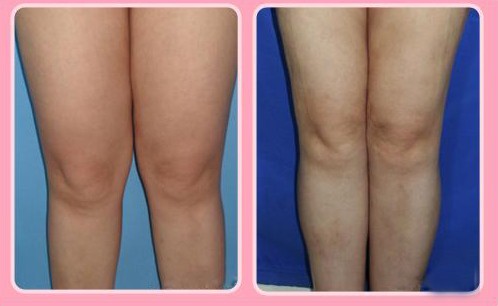 ��С����֬ǰ��(du��)�ȈD