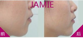 �S�°�ǰ��(du��)�ȈD