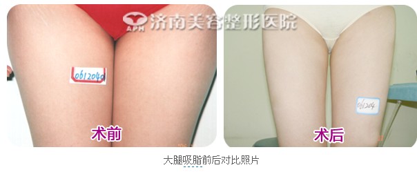 �Ȳ���֬��(du��)�ȈD