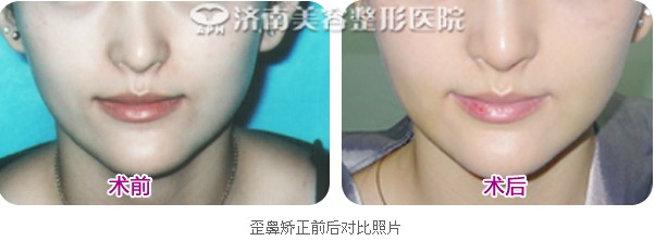 ��ǳC����(du��)�ȈD