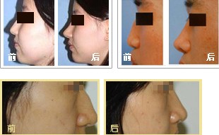 �nʽ¡�ǌ�(du��)�ȈD