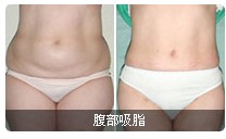 ������֬ǰ�󌦱ȈD