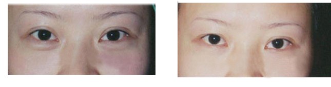 ȥ�۴�ǰ�󌦱ȈD