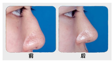 ��ǳC�����g(sh��)���ȈD