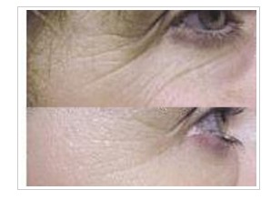 �~(y��)β�y������(du��)�ȈD