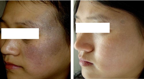 ̫�����ί�ǰ��(du��)�ȈD