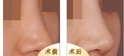 ���w¡�ǌ��ȈD