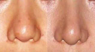 ��С������ǰ��(du��)�ȈD