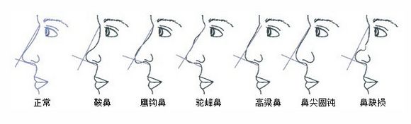 亚洲三大鼻王之刘国权10月5-7日广西总院整形亲诊