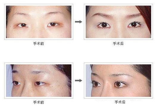 ���p��Ƥ�ɹ�����