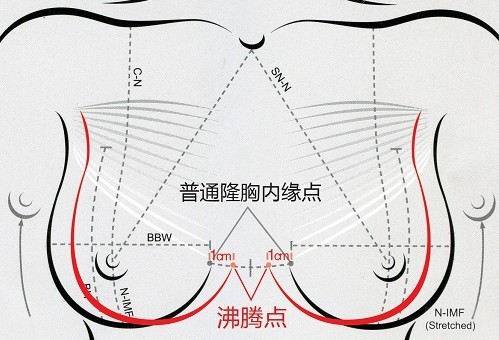 ���v���S��