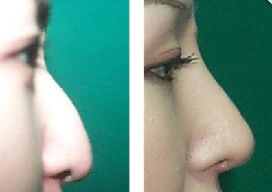 ��ǳC�����g(sh��)�ɹ�����