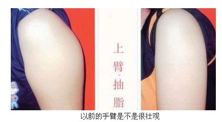 �ֱ���֬�ɹ�����