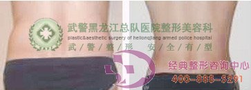 ��������֬�p�ʳɹ�����