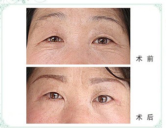 �zԭ����ע������~β�y�ɹ�����