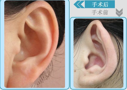 ���������g(sh��)�ɹ�����