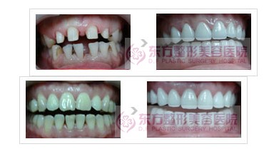 �������ޏ�(f��)����