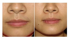 ����Ó��ë�ɹ�����