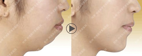 ע�䲣����¡�°ͳɹ�����