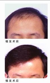 ֲ�l(f��)�������g(sh��)Ч���D